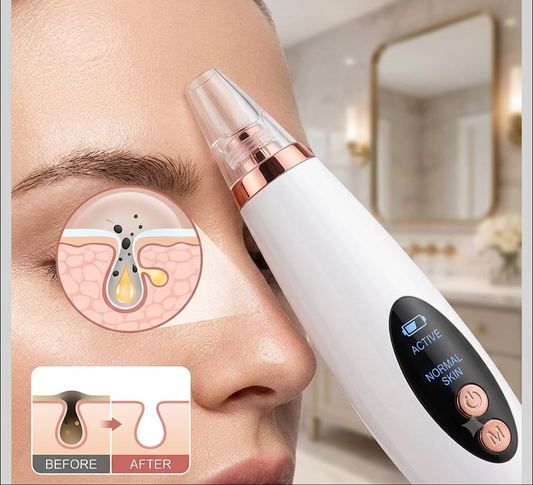 KD 6 in 1 Multi-function Blackhead Remover Tools | Electric Derma suction Machine | USB Rechargeable Acne Pimple Pore Cleaner Vacuum tool - Facial Cleanser Device for Nose & Skin Care (White)